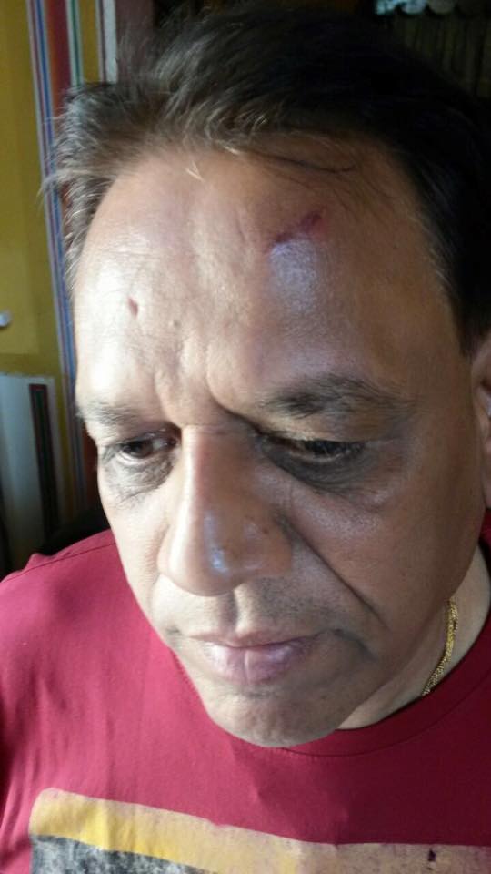 Injured Modi loyalist